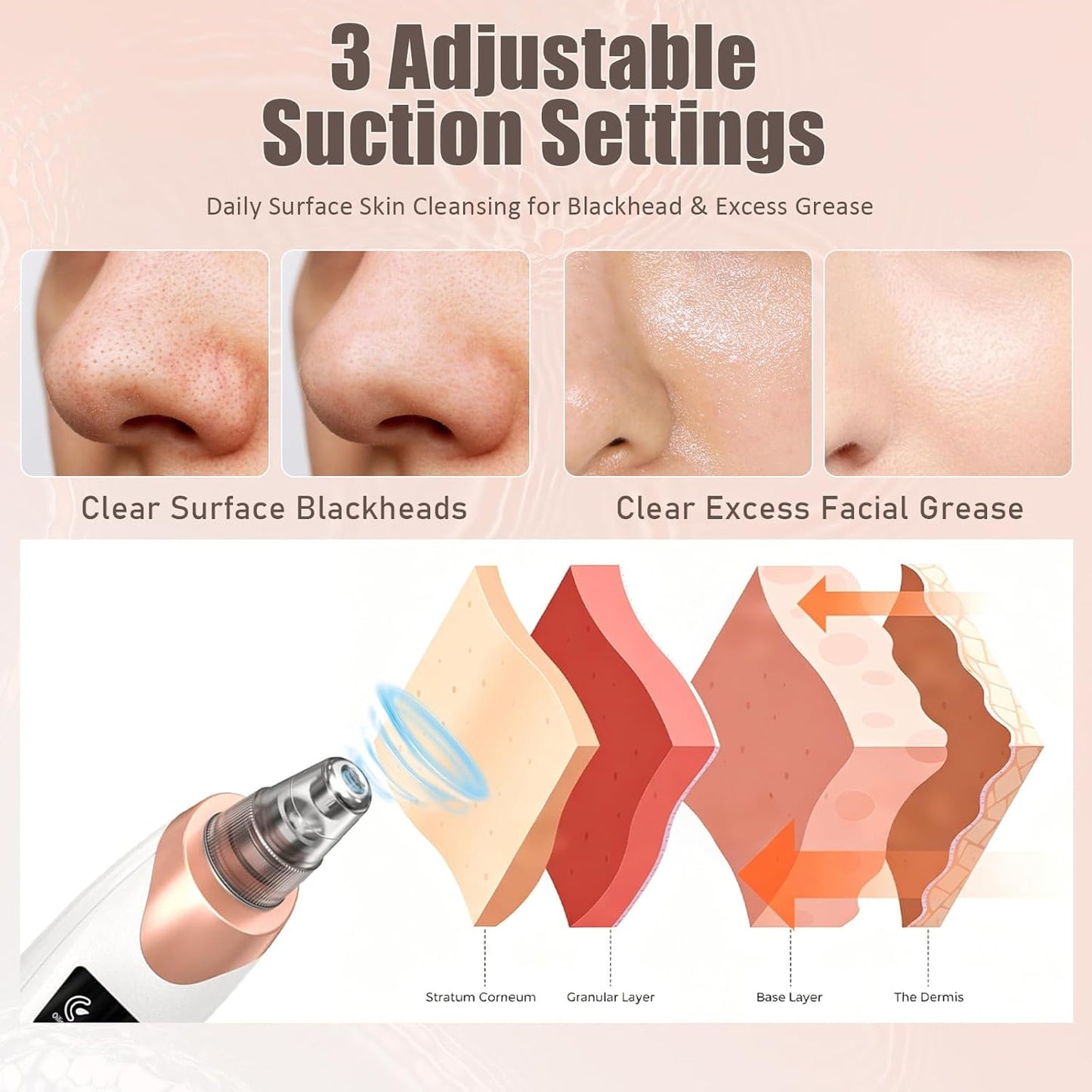 2026 Blackhead Remover Pore Vacuum